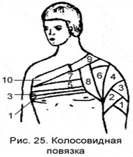 Колосовидная повязка. Колосовидная повязка на область плечевого сустава. Колосовидная повязка на плечевой сустав алгоритм. 16. Повязка колосовидная на плечевой сустав.. Колосовидная повязка при гидрадените.