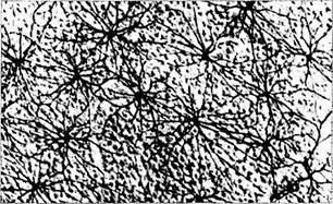 Что такое нейроглия сетчатки