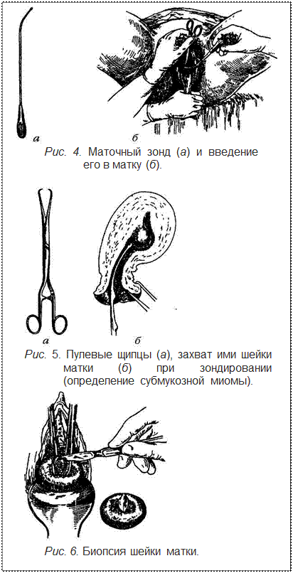 Гирудотерапия при миоме матки схема