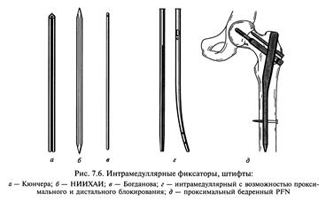 Схема цито травматология