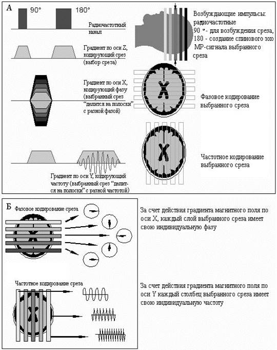 Физические основы мрт презентация