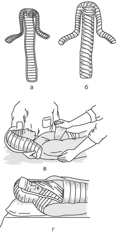 Изготовление ватно марлевого воротника для иммобилизации шейного отдела позвоночника