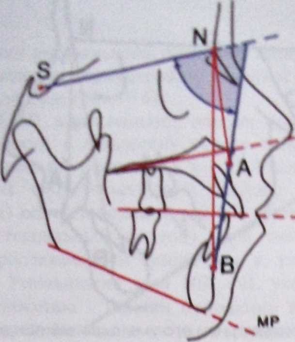 Угол spp mp. Угол SNB на ТРГ. SPP NSL угол ТРГ. NSL ml ТРГ. Угол SPP NSL ортодонтия.