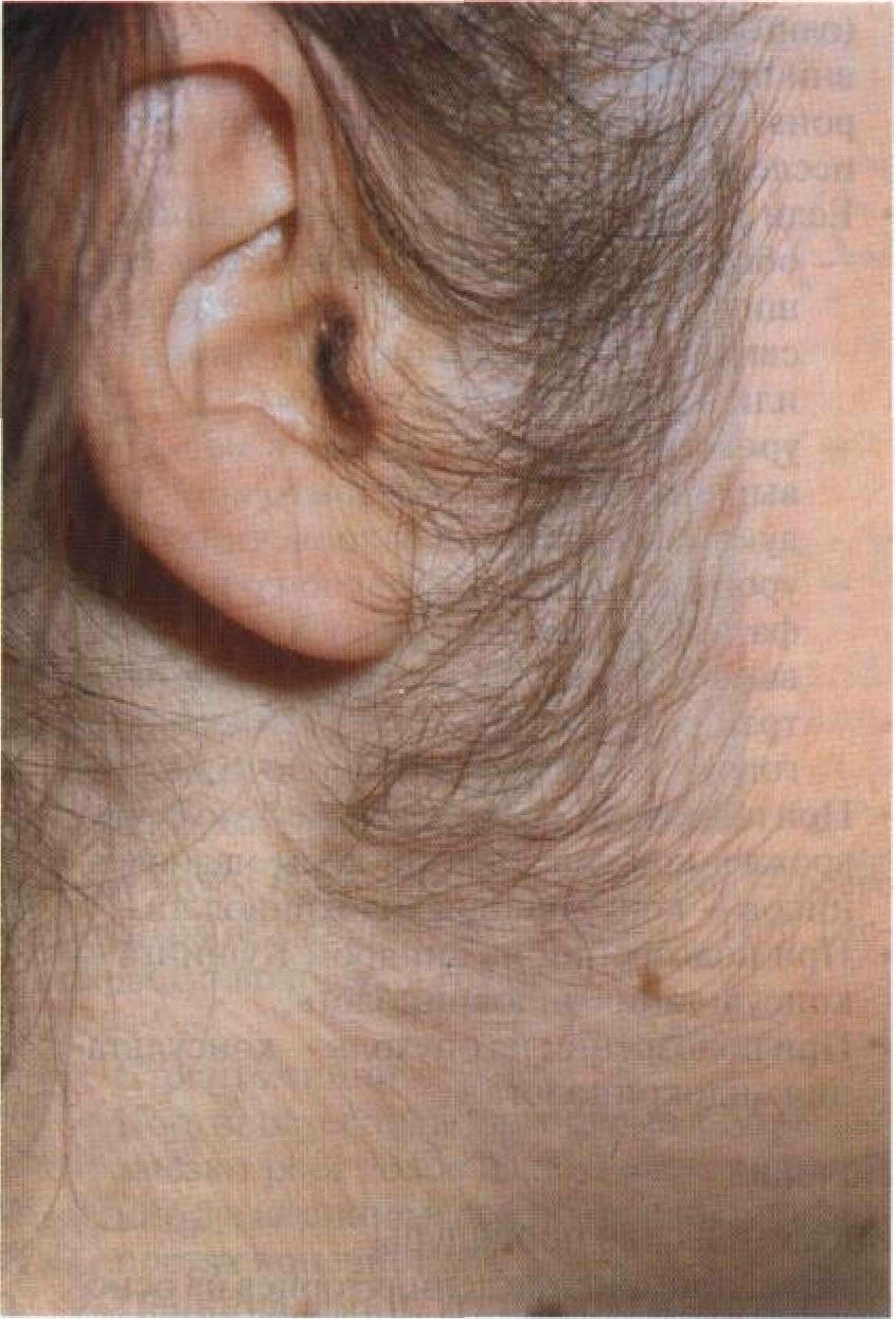 волосы на лице у женщин на груди фото 60
