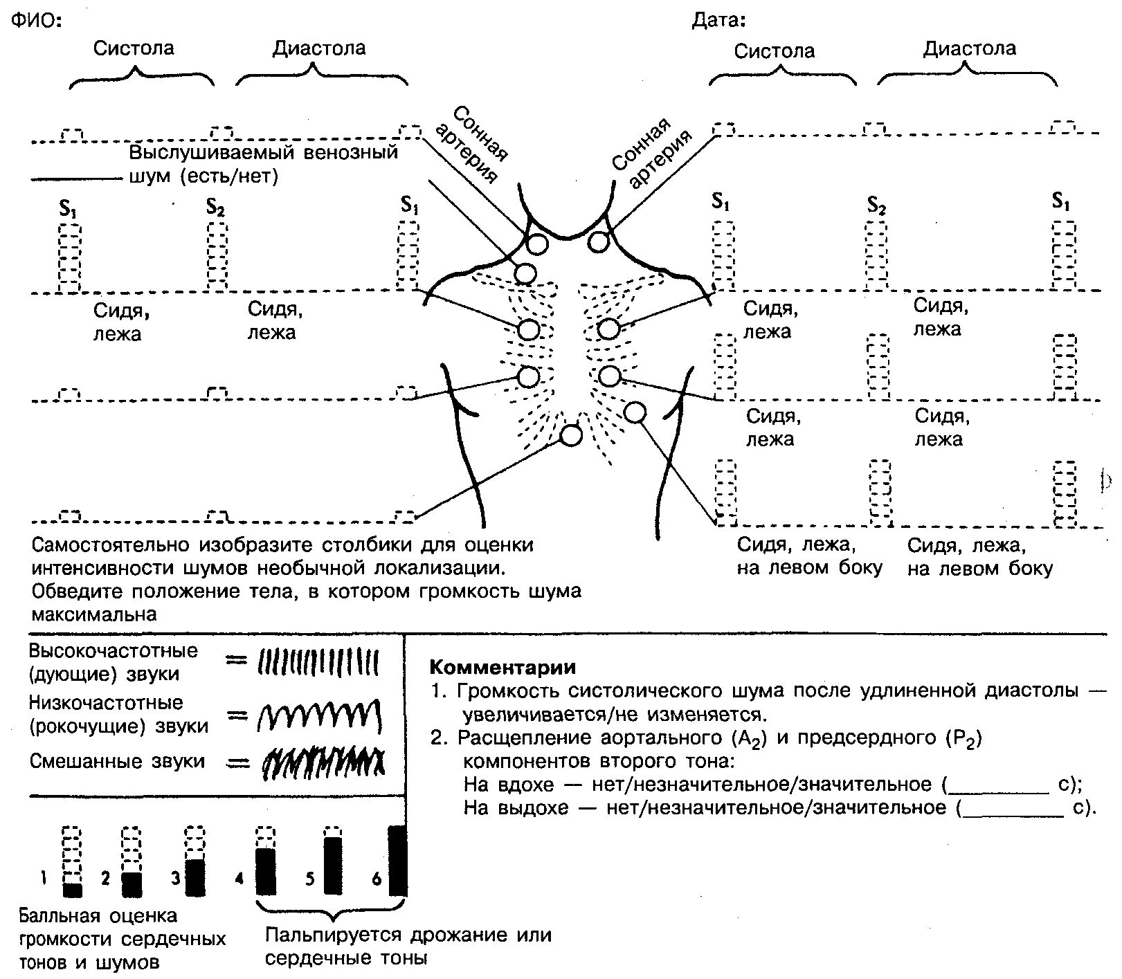 Для аускультативной картины дмпп характерно