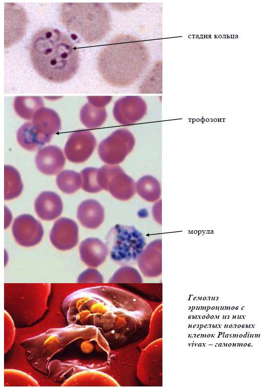 Малярийный плазмодий клетка. Малярийный плазмодий Vivax. Шизонт малярийного плазмодия строение. Малярийный плазмодий в эритроцитах крови. Малярийный плазмодий в клетках крови.