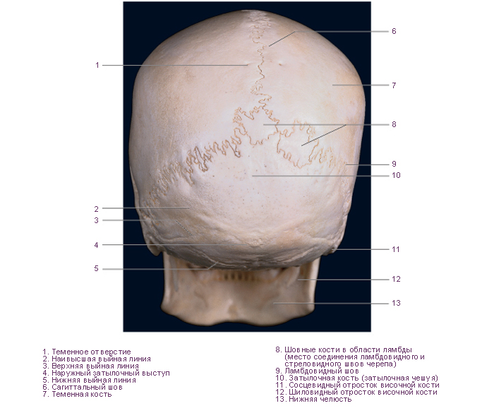 Шов между теменными костями. Соединения костей черепа анатомия швы. Соединение костей черепа швы. Венечный шов соединяет кости черепа. Венечный шов черепа анатомия.