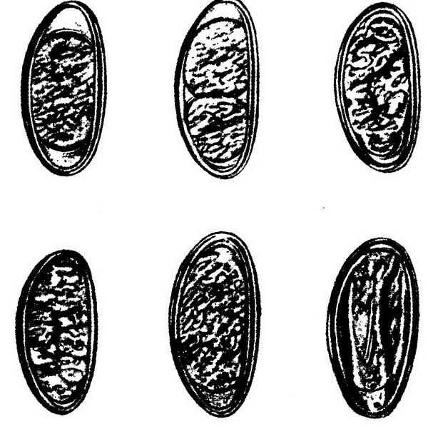 Яйца остриц. Инвазионное яйцо острицы. Диагностические признаки яйца острицы. Паразитология яйца паразитов модель 3д. Гельминты рисунок.