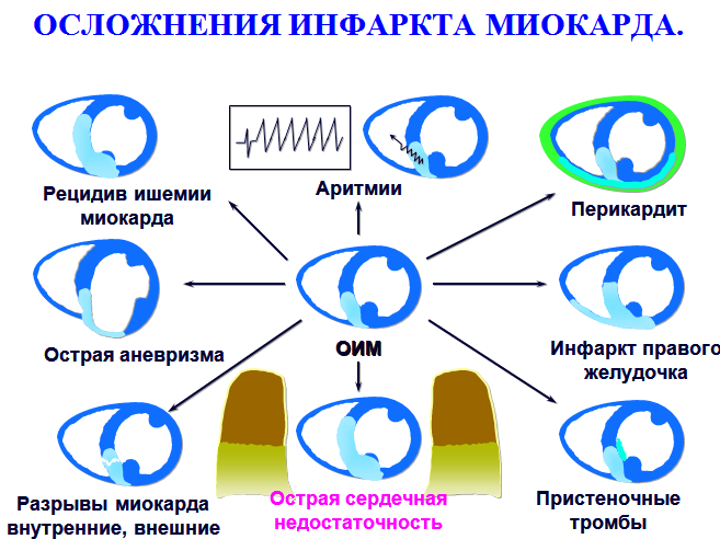 Школьная карта пц аксиома вход