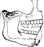 Мыщелки нижней челюсти. Вспомогательная модель нижней челюсти. Угол головки мыщелка нижней челюсти. Измерение импульса при движении челюсти.