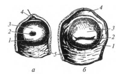 Шейка матки конической формы. Анатомия матки наружный зев. Наружный зев нерожавшей женщины. Форма наружного зева шейки матки. Наружный зев шейки матки щелевидный.