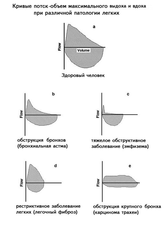 На рисунке lb dn bm md