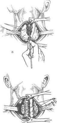 Сосудистый рисунок усилен щитовидной железы паренхимы