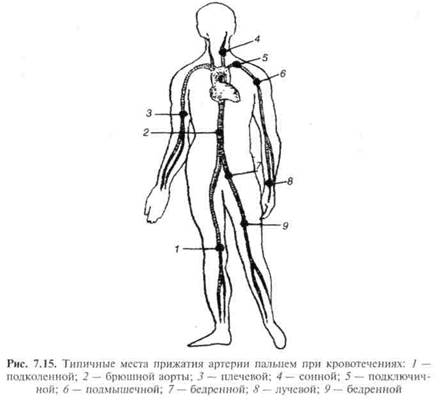 Покажите на рисунке из учебного пособия точки прижатия важнейших артерий сонной